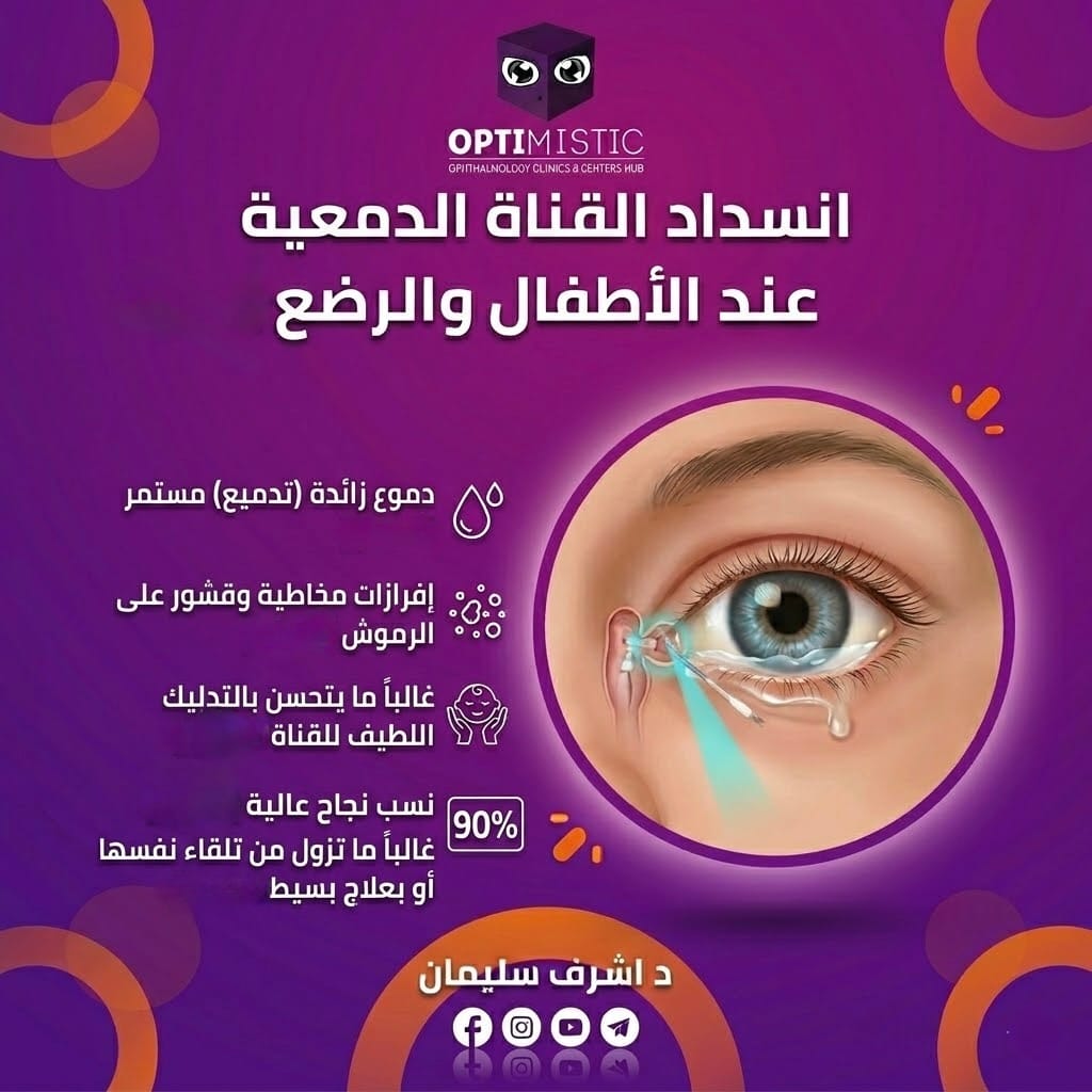 انسداد القناة الدمعية عند الأطفال