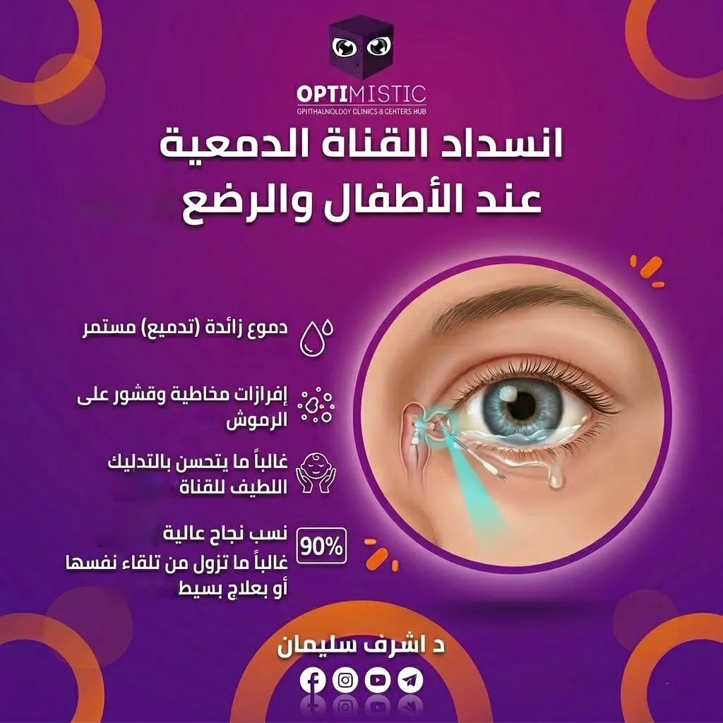 انسداد القناة الدمعية عند الأطفال