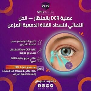 عملية DCR بالمنظار