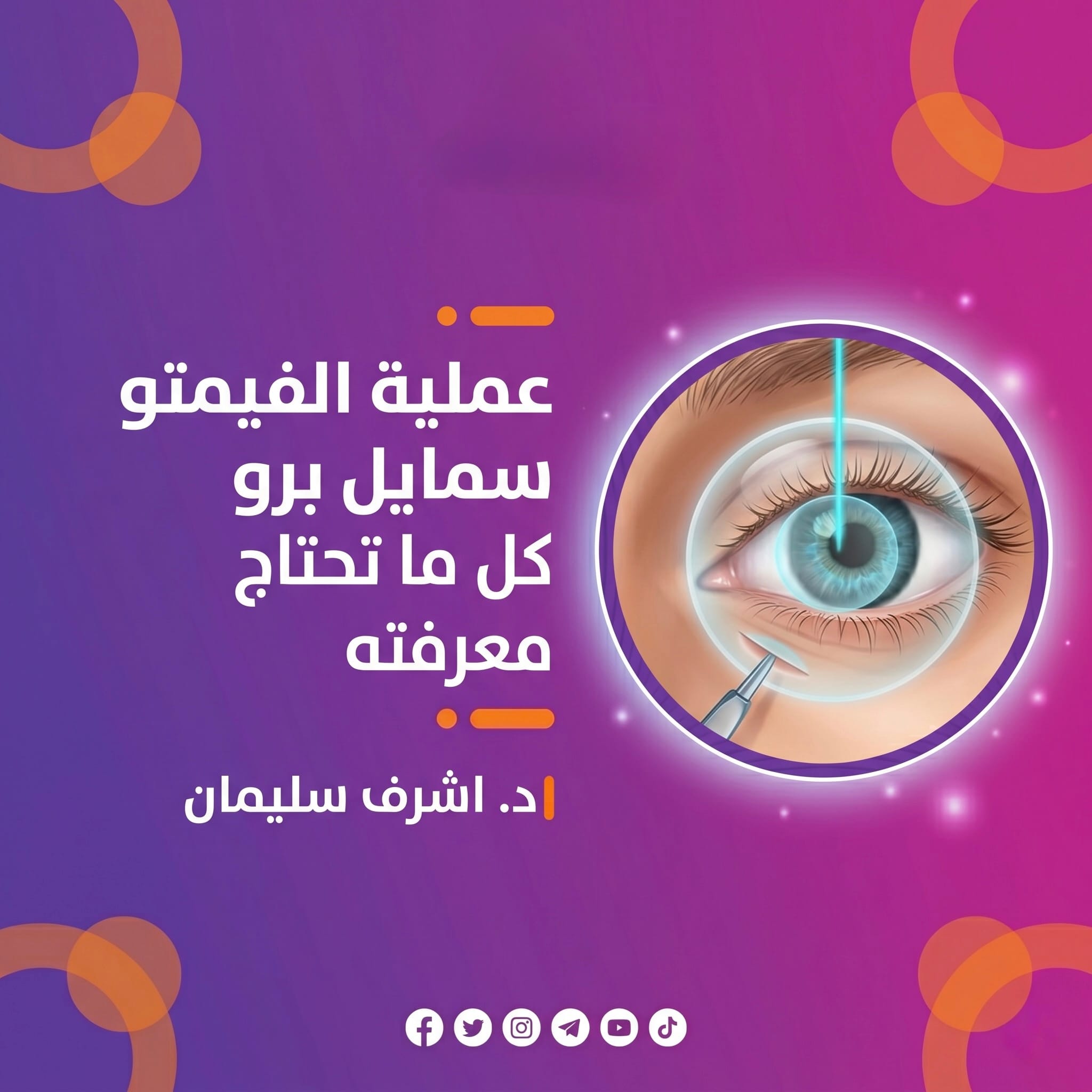 عملية الفيمتو سمايل برو